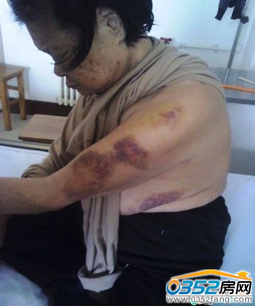 ���˱��w�[��